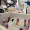 Caccia al patogeno, Oms convoca oltre 300 scienziati