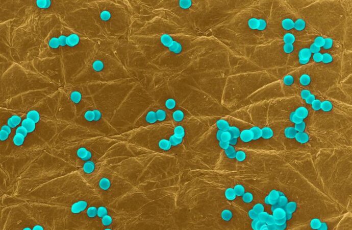 Infezioni da superbatteri costano circa 1 miliardo all’anno, roadmap con 10 priorità